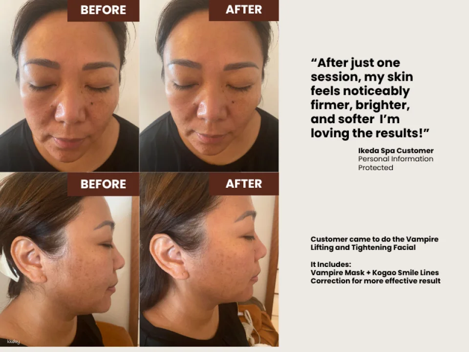 60 Mins Kohaku Vampire Lifting Facial @ Ikeda Spa in Bukit Timah | Experience the Art of Japanese Spa in Singapore