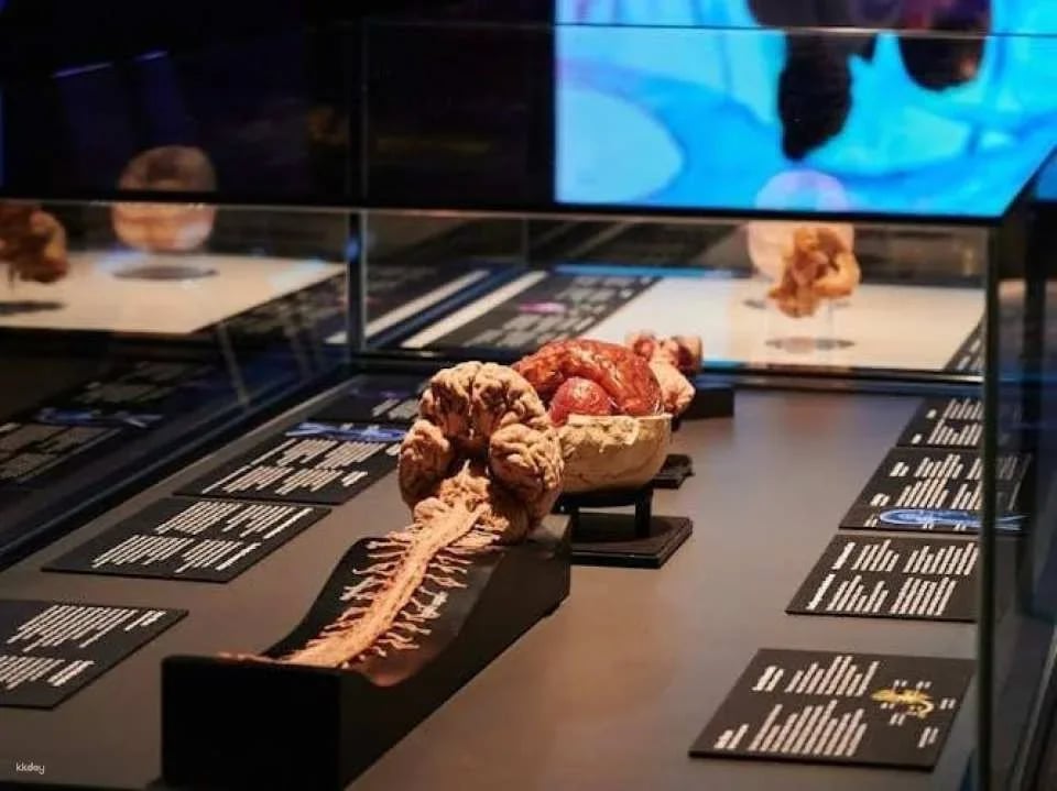 Body Worlds exhibition in Münster