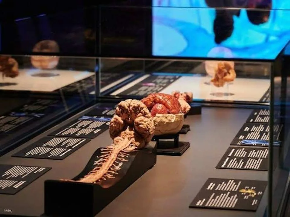 Body Worlds exhibition in Münster